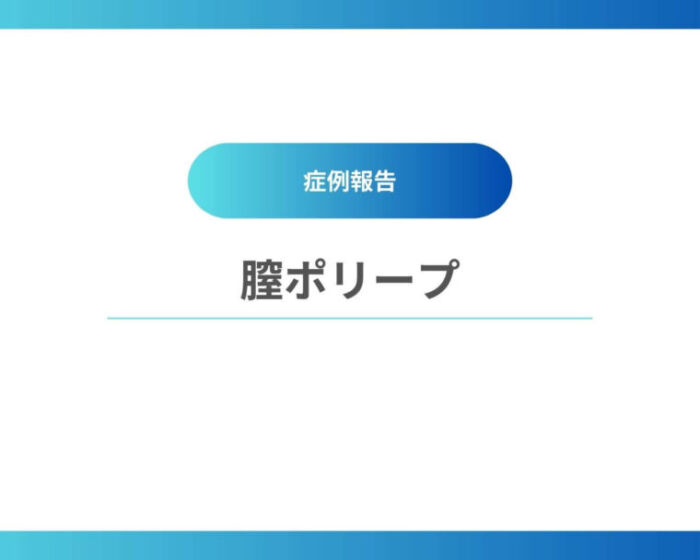 青　白　シンプル　ビジネス　営業資料　サービスの提案書　プレゼンテーション　 (1)